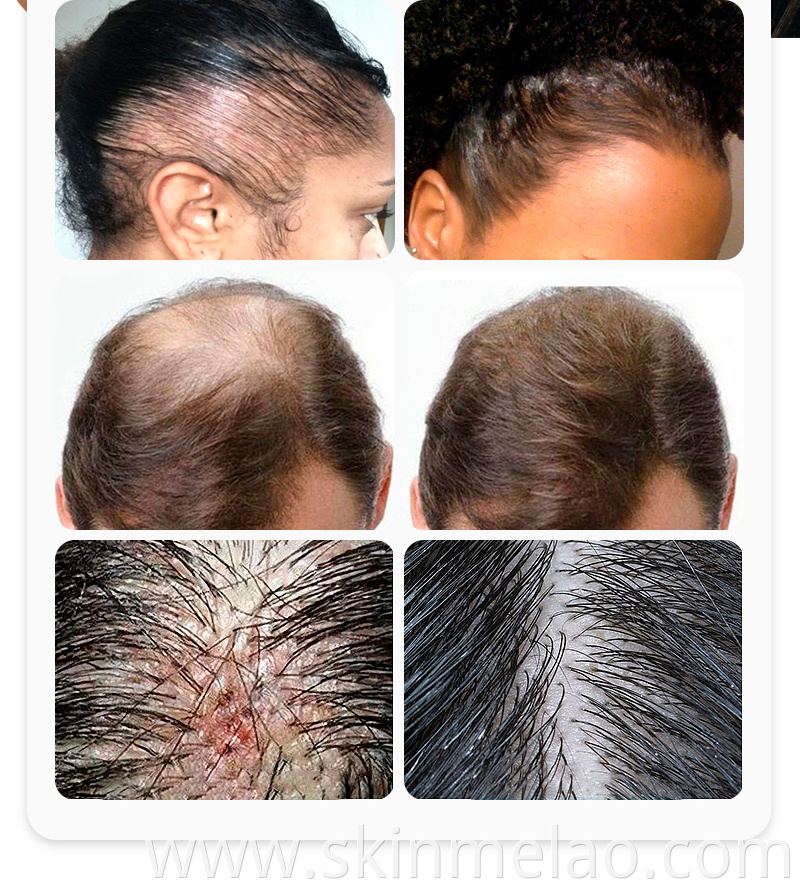 Hair Growth Fluid 05